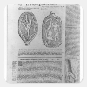 Fetus, Illustration von "Oeuvres" Quadratischer Aufkleber