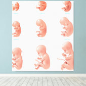 Fetus Leinwanddruck (Insitu (Holzboden))