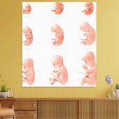 Fetus Leinwanddruck (Insitu (Wohnzimmer))