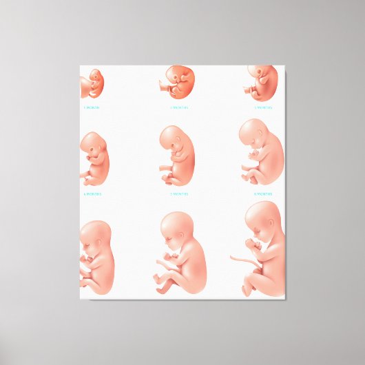 Fetus Leinwanddruck (Vorderseite)