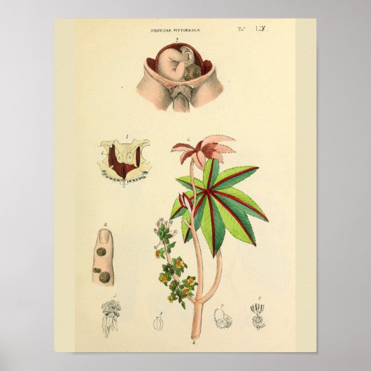 Fetus Position Uterus Vintage Anatomie Art Print Poster (Vorne)