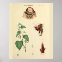 Fetus Uterus Vintage Anatomie Art Print