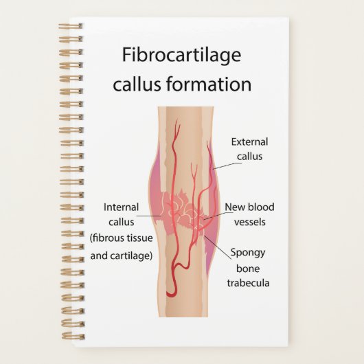 Fibrocartilage Callus formation Planer (Vorderseite)