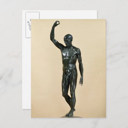 Flayed Body Postkarte (Vorne/Hinten)