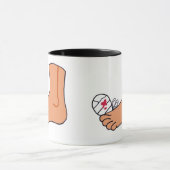 Foot-2 gebrochene Zehe Tasse (Zentrum)