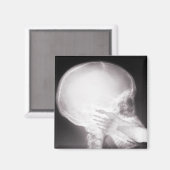 Foot in Mouth X-Ray Magnet (Vorderseite/Rückseite)