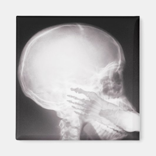 Foot in Mouth X-Ray Magnet (Vorne)