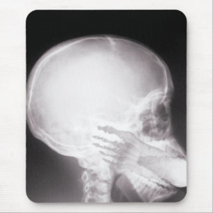 Foot in Mouth X-Ray Mousepad