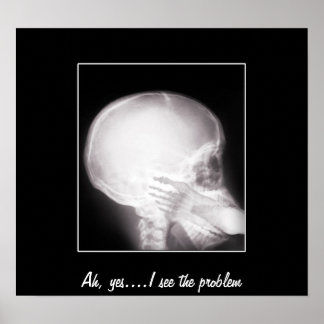 Foot in Mouth X-Ray Poster