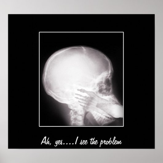 Foot in Mouth X-Ray Poster (Vorne)