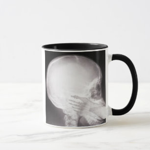 Foot in Mouth X-Ray Tasse