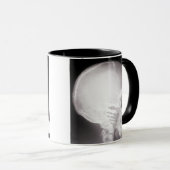 Foot in Mouth X-Ray Tasse (VorderseiteRechts)