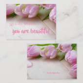 Förderung der Erinnerung; Sie sind wunderschön Begleitkarte (Vorne/Hinten)