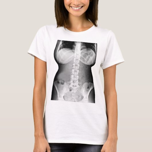 Foto-Abbildung T-Shirt (Vorderseite)
