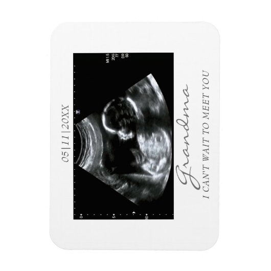 Foto Magnet Ultrasound Geschenke für Oma Sonogram (Vertikal)