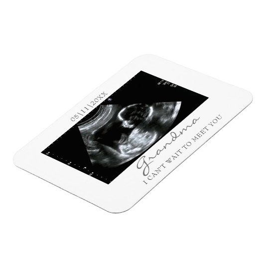 Foto Magnet Ultrasound Geschenke für Oma Sonogram (Linke Seite)
