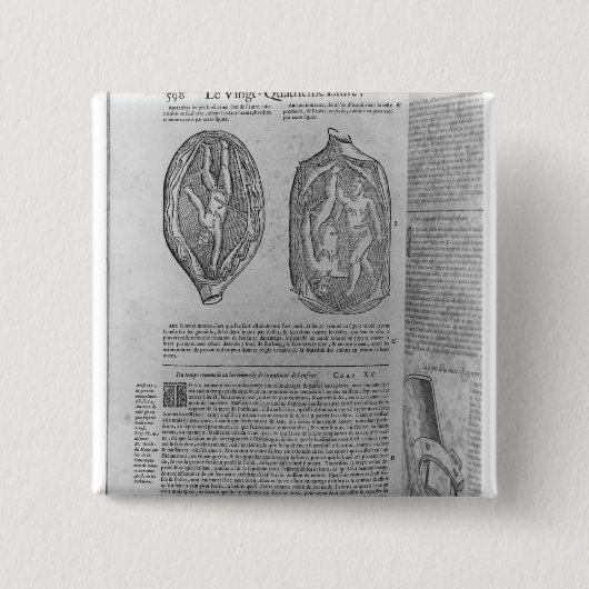 Fötus, Illustration 'von den Gesamtwerken Button (Vorderseite)