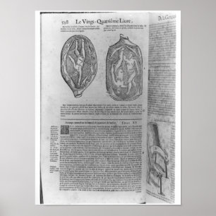 Fötus, Illustration 'von den Gesamtwerken Poster