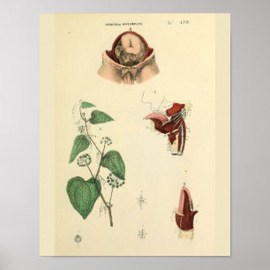 Fötus Uterus Vintage Anatomie Kunst Druck Poster