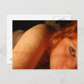 Freckles Postkarte (Vorne/Hinten)