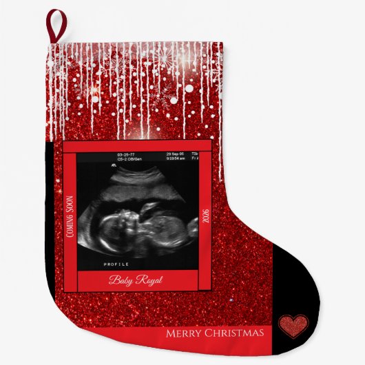 Frohe Weihnachts Sonogram Baby kommt bald Großer Weihnachtsstrumpf (Vorderseite)