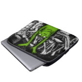 Froschfrosche Laptopschutzhülle (Vorne Knopf)