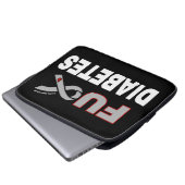 FU Diabetes Laptopschutzhülle (Vorne Knopf)