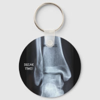 Funny Broken Fibula Xray "Break Time"