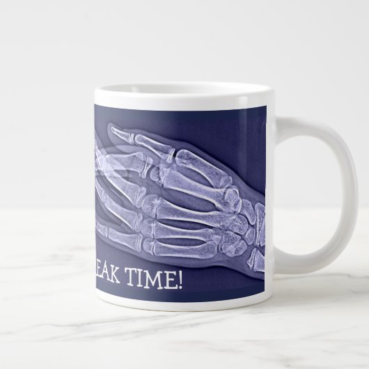 Funny Broken Finger Xray "Break Time" Jumbo-Tasse (Rechts)