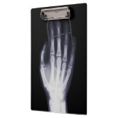 Funny Hand Röntgen für Internet-Drogensüchtige Klemmbrett (Links)