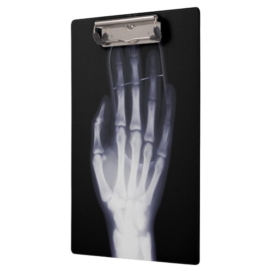 Funny Hand Röntgen für Internet-Drogensüchtige Klemmbrett (Links)