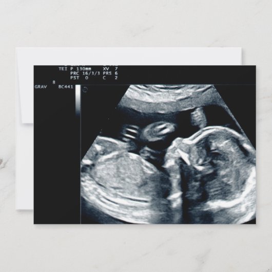 Funny niedlich avocado Ultraschall Foto Schwangers Ankündigung (Rückseite)