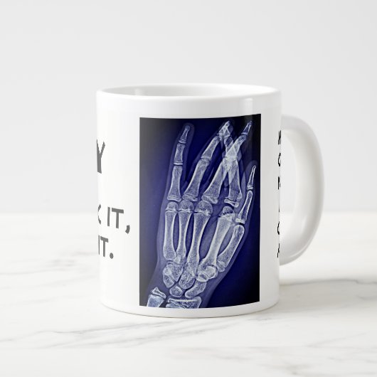 Funny"Röntgen. Sie brechen es, wir nehmen es" & Ha Jumbo-Tasse (Vorderseite Rechts)