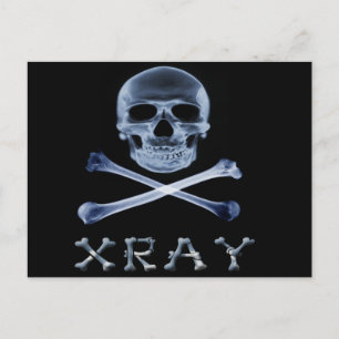 FUNOLOGIE-PIRATENFLAGGE des XRAY PIRATE-Flag Postkarte