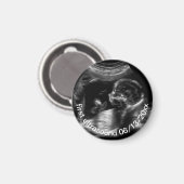 Für Neugeborene: First Ultrasound Sonogram Baby Magnet (Vorderseite/Rückseite)