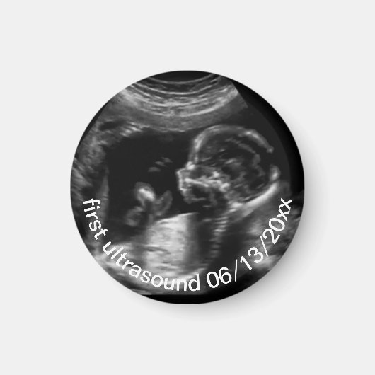 Für Neugeborene: First Ultrasound Sonogram Baby Magnet (Vorne)