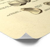 Fußknöchelanatomie Tarsal Knochen drucken Poster (Ecke)