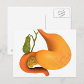 Gallenblase mit Magenschmerzen Postkarte (Vorne/Hinten)