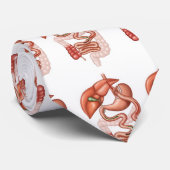 Gastrische Überbrückungs-Krawatte Krawatte (Gerollt)