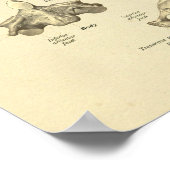 Gebärmutterhalskrebs Anatomie Atlas Axis Print Poster (Ecke)