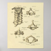 Gebärmutterhalskrebs Anatomie Atlas Axis Print Poster (Vorne)