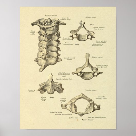 Gebärmutterhalskrebs Anatomie Atlas Axis Print Poster (Vorne)