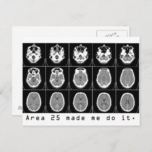 Gebiet 25 hat mich dazu gebracht, es zu tun. postkarte (Vorne/Hinten)
