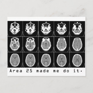 Gebiet 25 hat mich dazu gebracht, es zu tun. postkarte