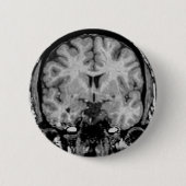 Gehirn MRI, Kranzscheibe Button (Vorderseite)