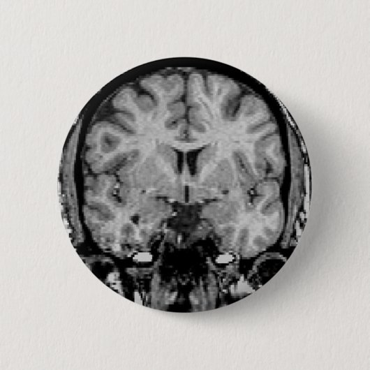 Gehirn MRI, Kranzscheibe Button (Vorderseite)