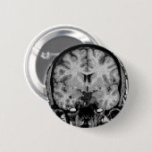 Gehirn MRI, Kranzscheibe Button (Vorne & Hinten)
