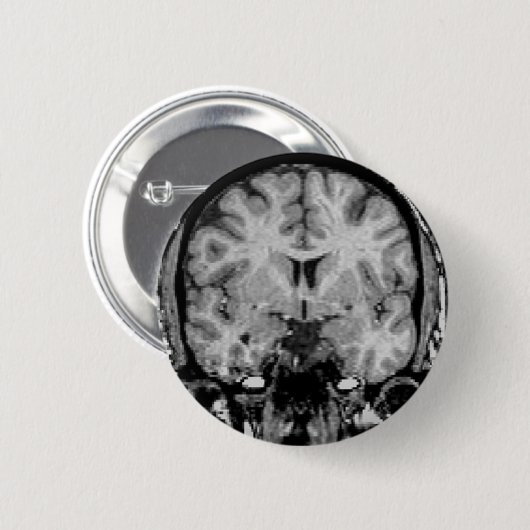 Gehirn MRI, Kranzscheibe Button (Vorne & Hinten)