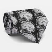 Gehirn - MRI Krawatte (Gerollt)