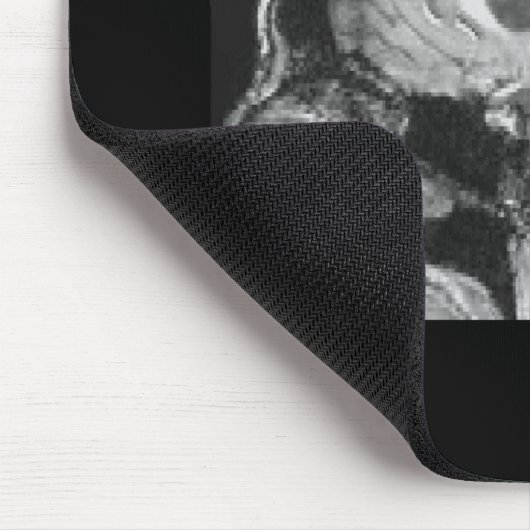 Gehirn MRI Mousepad (Ecke)